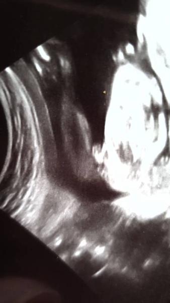 Bild zu Mädchen oder Junge 23 + 0? - Schwanger - wer noch? Rund um die Schwangerschaft
