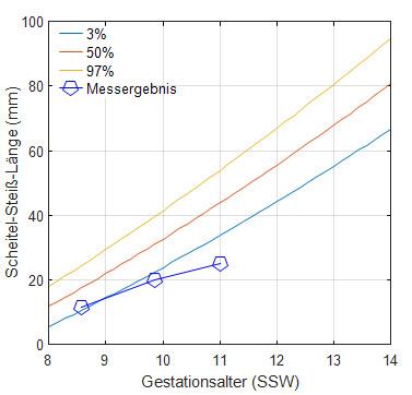 Bild zu Wachstum zu langsam? (1. Trimester) - Schwanger - wer noch? Rund um die Schwangerschaft