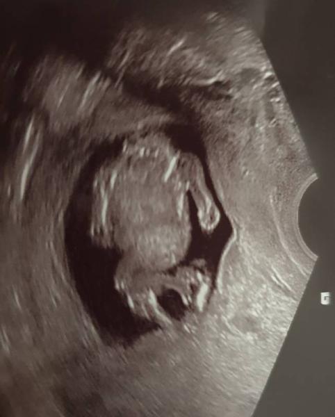 Bild zu Mädchen oder Junge? :) - Schwanger - wer noch? Rund um die Schwangerschaft