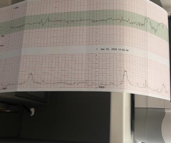 Bild zu Wehen ? - Schwanger - wer noch? Rund um die Schwangerschaft