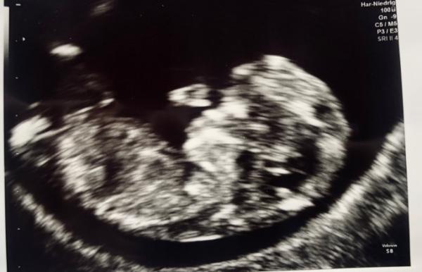 Bild zu Junge oder Mädchen? - Schwanger - wer noch? Rund um die Schwangerschaft