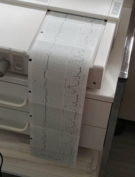 Bild zu Schmerzen 37 SSW - Schwanger - wer noch? Rund um die Schwangerschaft
