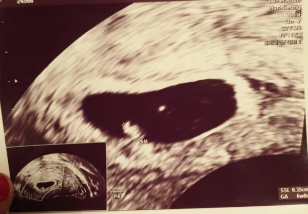 Bild zu Mädchen oder Junge? :) - Schwanger - wer noch? Rund um die Schwangerschaft