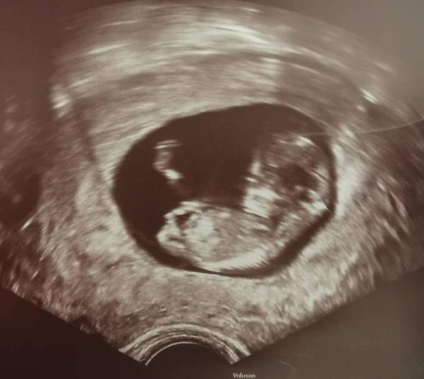 Bild zu Nub Theorie - 12.ssw - Schwanger - wer noch? Rund um die Schwangerschaft