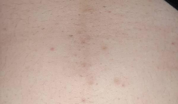 Bild zu Schwanger? - Schwanger - wer noch? Rund um die Schwangerschaft