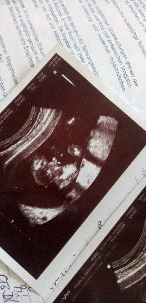 Bild zu Ist das ein Junge? - Schwanger - wer noch? Rund um die Schwangerschaft