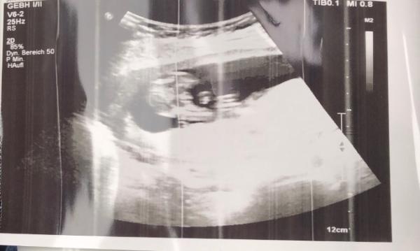 Bild zu Geschlecht/ Junge oder Mädchen ? - Schwanger - wer noch? Rund um die Schwangerschaft