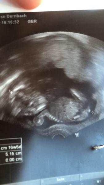 Bild zu Mädchen oder Junge?? - Schwanger - wer noch? Rund um die Schwangerschaft
