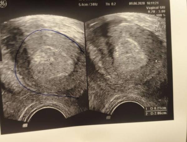 Bild zu US 5+1 - Schwanger - wer noch? Rund um die Schwangerschaft