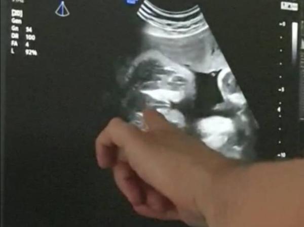 Bild zu Was denkt ihr was es wird? - Schwanger - wer noch? Rund um die Schwangerschaft