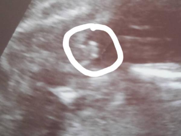 Bild zu Mädchen oder Junge? :) - Schwanger - wer noch? Rund um die Schwangerschaft