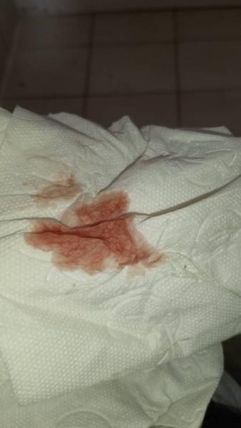 Bild zu Blutung!!! Hilfe - Schwanger - wer noch? Rund um die Schwangerschaft