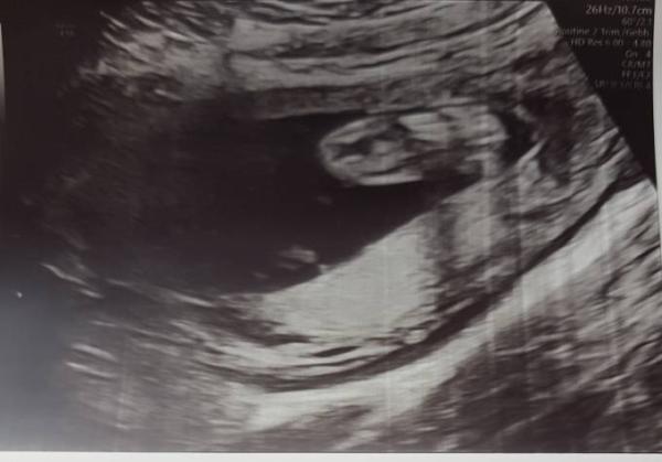 Bild zu He or she - Schwanger - wer noch? Rund um die Schwangerschaft