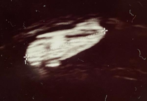 Bild zu 6 Zehen - Schwanger - wer noch? Rund um die Schwangerschaft