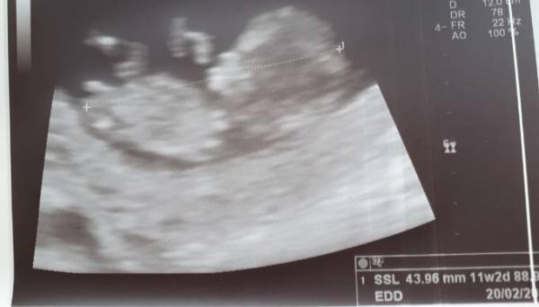 Bild zu 11+2 ssw - Junge?? - Schwanger - wer noch? Rund um die Schwangerschaft