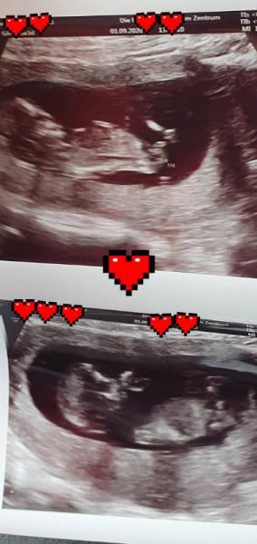 Bild zu Junge oder Mädchen? - Schwanger - wer noch? Rund um die Schwangerschaft