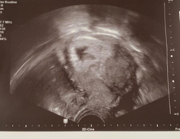 Bild zu Ssw 7 - Schwanger - wer noch? Rund um die Schwangerschaft