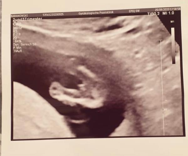 Bild zu Geschlecht des Babys - Schwanger - wer noch? Rund um die Schwangerschaft