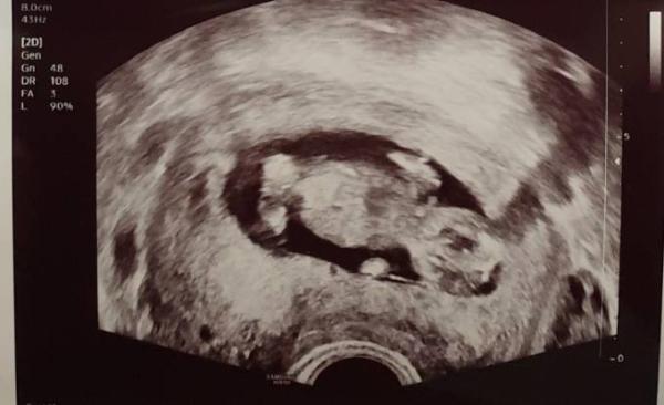 Bild zu Geschlecht? - Schwanger - wer noch? Rund um die Schwangerschaft