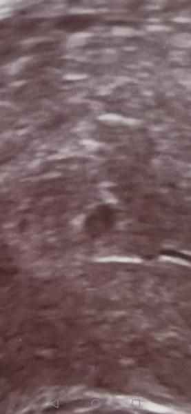 Bild zu Ist da was in der Fruchthöhle? - Schwanger - wer noch? Rund um die Schwangerschaft