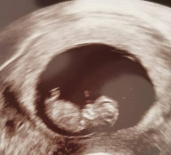 Bild zu Skull Theorie - Schwanger - wer noch? Rund um die Schwangerschaft