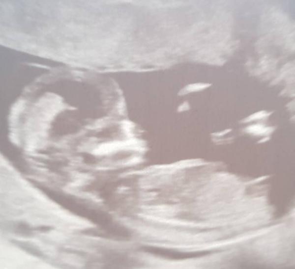 Bild zu Junge oder Mädel? - Schwanger - wer noch? Rund um die Schwangerschaft
