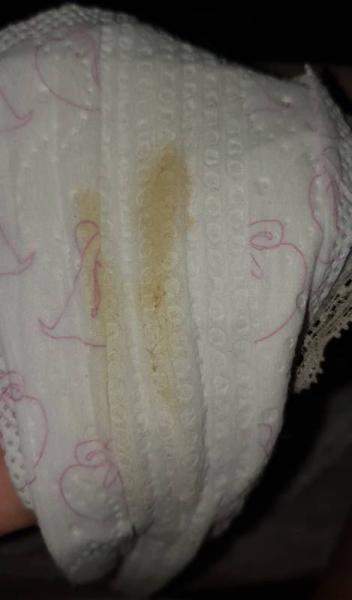 Bild zu Ausfluss - Schwanger - wer noch? Rund um die Schwangerschaft