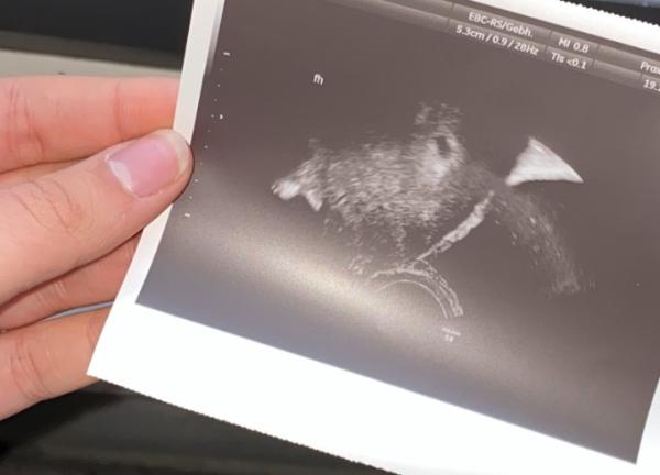 Bild zu Ultraschall 5+2 - Schwanger - wer noch? Rund um die Schwangerschaft