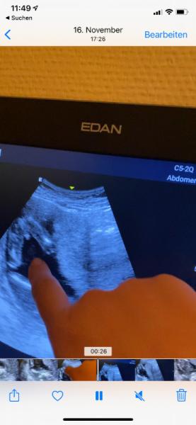 Bild zu Geschlecht - Schwanger - wer noch? Rund um die Schwangerschaft