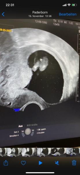Bild zu Junge oder Mädchen - Schwanger - wer noch? Rund um die Schwangerschaft