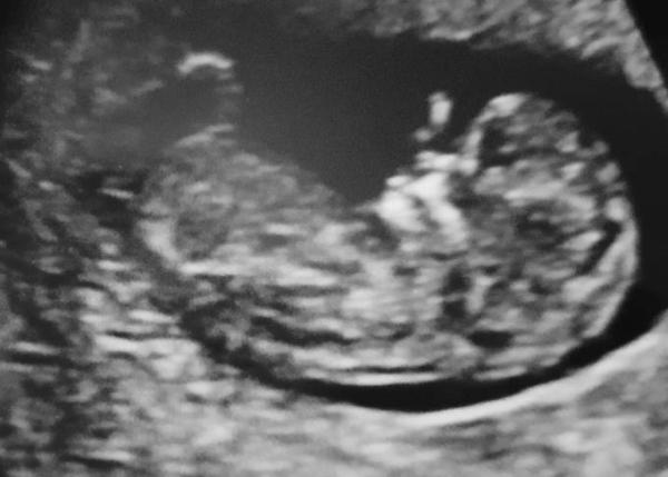 Bild zu Nub Theorie - Schwanger - wer noch? Rund um die Schwangerschaft