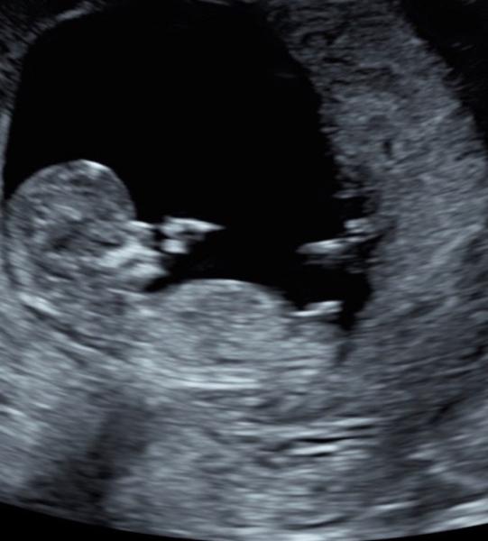 Bild zu Nub theorie ssw12 - Schwanger - wer noch? Rund um die Schwangerschaft