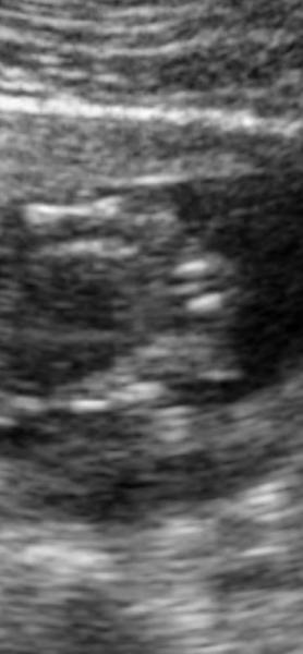 Bild zu Wie sah es bei euren Mädels/Jungs aus? - Schwanger - wer noch? Rund um die Schwangerschaft