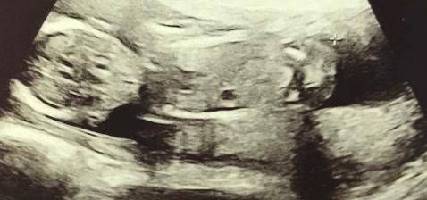 Bild zu Geschlecht - Schwanger - wer noch? Rund um die Schwangerschaft