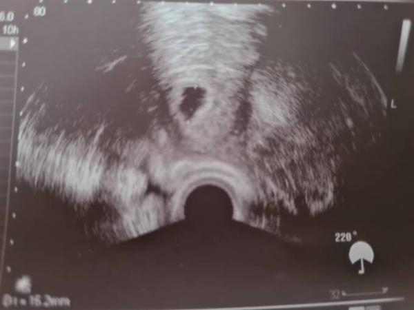 Bild zu 6SSW - Schwanger - wer noch? Rund um die Schwangerschaft