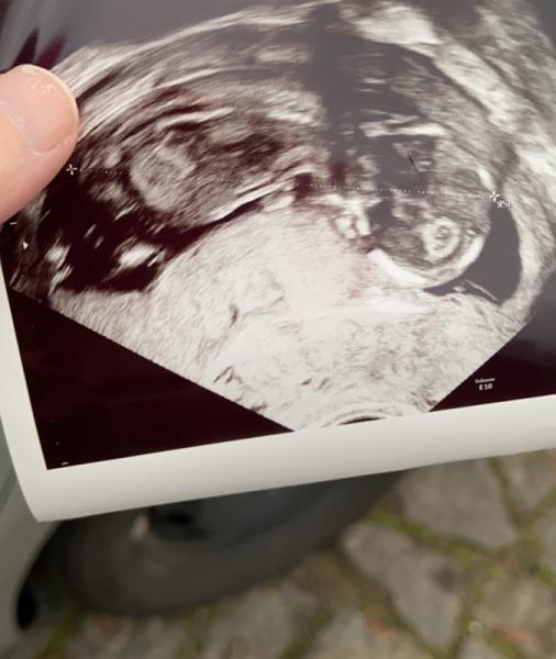 Bild zu Nub ? - Schwanger - wer noch? Rund um die Schwangerschaft