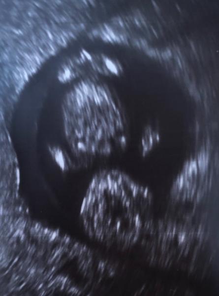 Bild zu Junge oder Mädchen Deutung US Bild - Schwanger - wer noch? Rund um die Schwangerschaft
