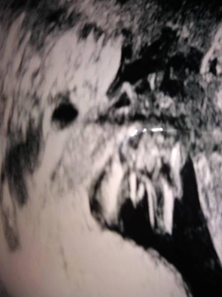 Bild zu Junge - Schwanger - wer noch? Rund um die Schwangerschaft