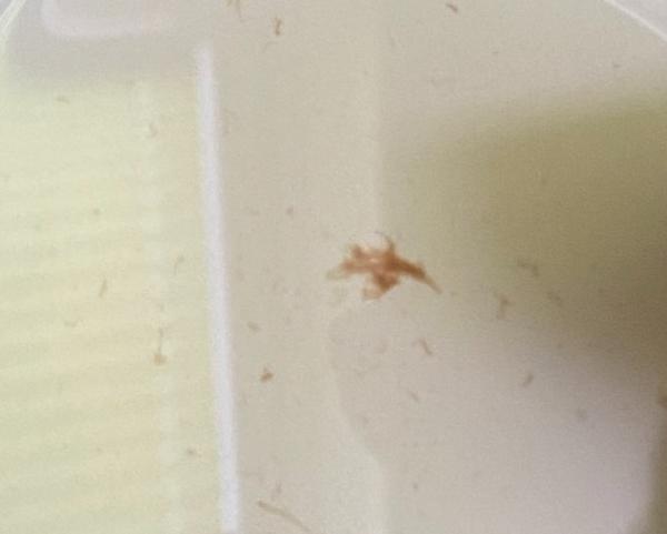 Bild zu Leichte Blutung SSW6 - Schwanger - wer noch? Rund um die Schwangerschaft