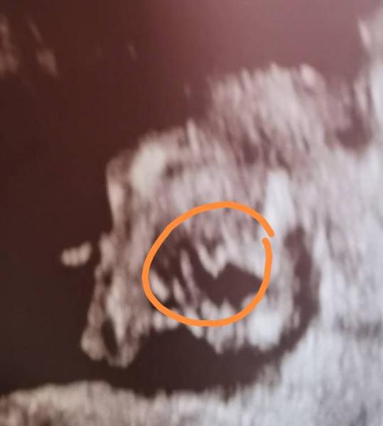 Bild zu Bub oder mädchen??? - Schwanger - wer noch? Rund um die Schwangerschaft