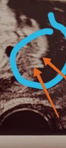 Bild zu Mädchen oder Junge? - Schwanger - wer noch? Rund um die Schwangerschaft