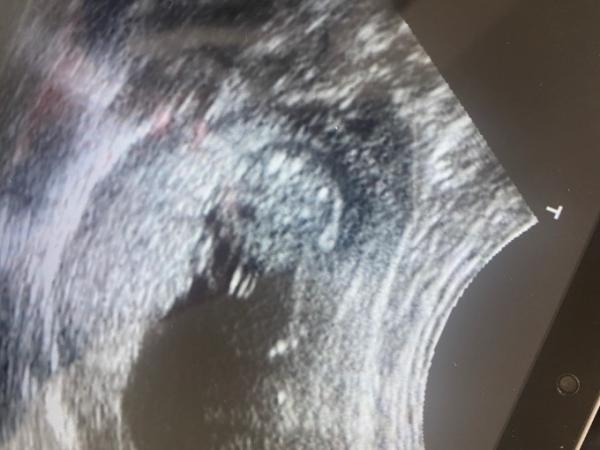 Bild zu Geschlecht? - Schwanger - wer noch? Rund um die Schwangerschaft