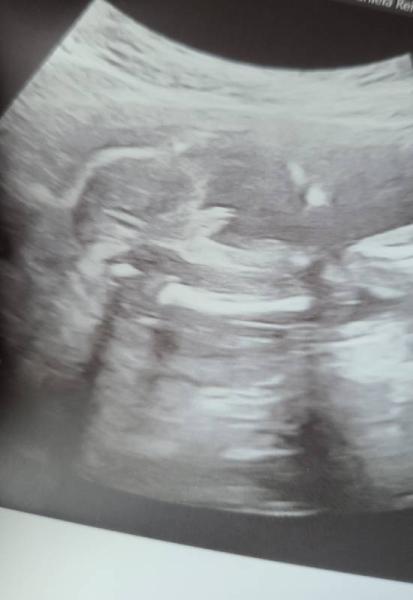 Bild zu Junge oder Mädchen? - Schwanger - wer noch? Rund um die Schwangerschaft