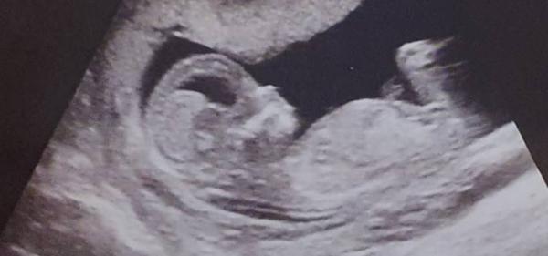 Bild zu Könnt ihr das Geschlecht erkennen? - Schwanger - wer noch? Rund um die Schwangerschaft