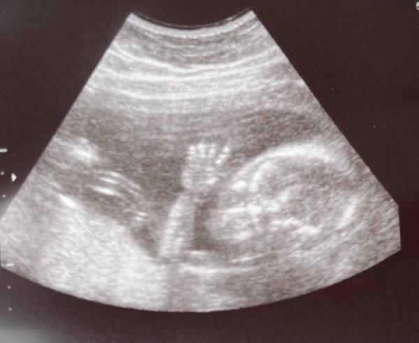 Bild zu 2. Organscreening - Schwanger - wer noch? Rund um die Schwangerschaft