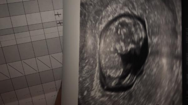 Bild zu NUB Theorie - Schwanger - wer noch? Rund um die Schwangerschaft