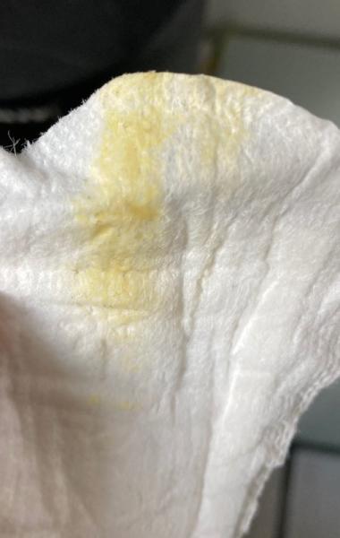 Bild zu Gelber Ausfluss Schwangerschaft - Schwanger - wer noch? Rund um die Schwangerschaft