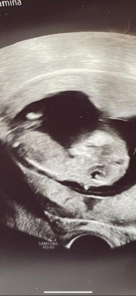 Bild zu Nub Theorie - Schwanger - wer noch? Rund um die Schwangerschaft