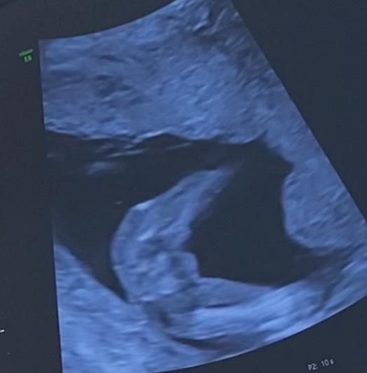 Bild zu Geschlecht - Schwanger - wer noch? Rund um die Schwangerschaft