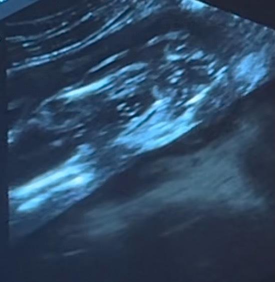 Bild zu Junge oder mädchen? - Schwanger - wer noch? Rund um die Schwangerschaft